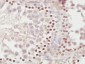 METTL11A Polyclonal Antibody